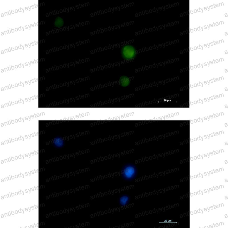 Валидация IF - AntibodySystem RHD73607