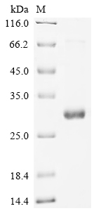 SDS-PAGE