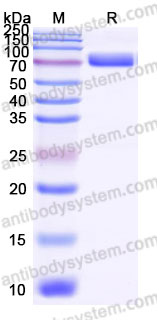 AHJ36502, SDS-PAGE