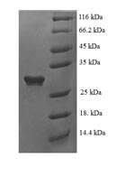 SDS-PAGE