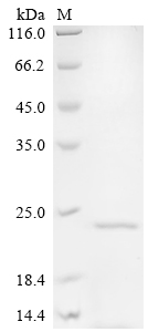 SDS-PAGE