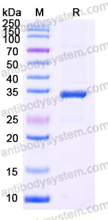 YHD54302, SDS-PAGE