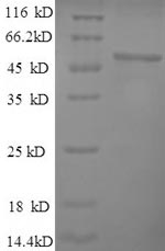 SDS-PAGE