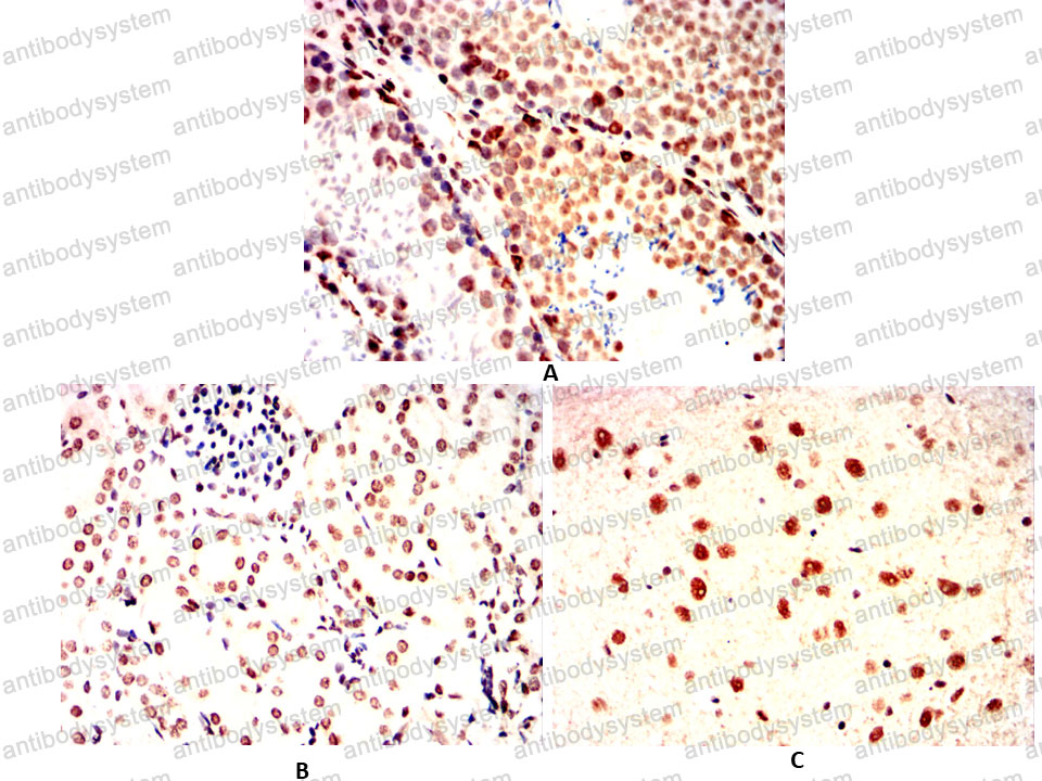 Валидация AntibodySystem RHC03209 (561)