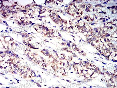 Валидация AntibodySystem RHJ42802