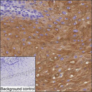 Валидация AntibodySystem RHD31704