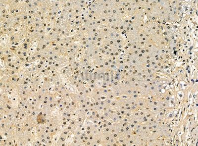 Валидация Affinity DF14451 - 10423