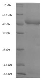 SDS-PAGE