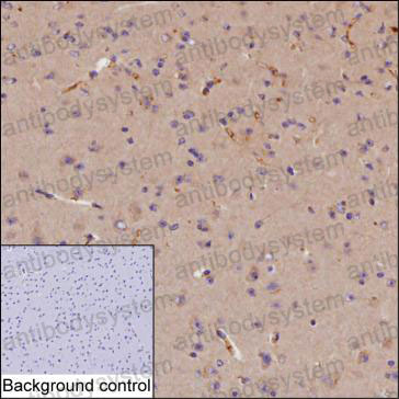 Валидация AntibodySystem RHC05203