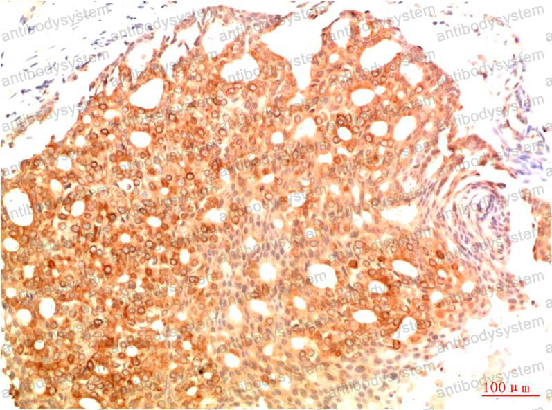 Валидация AntibodySystem RHC10010