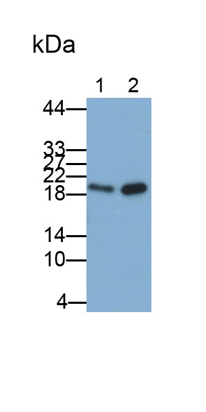 30858