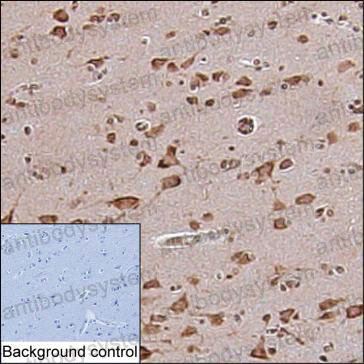 Валидация AntibodySystem RHP11602