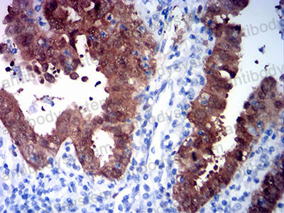 Валидация AntibodySystem RHE37710