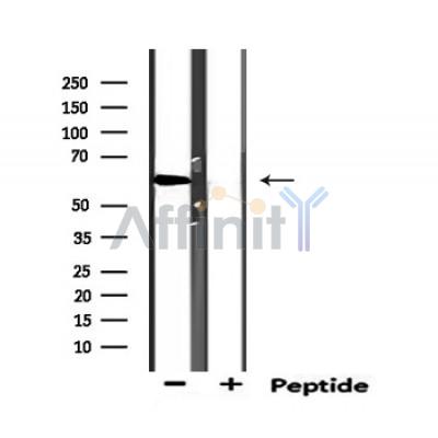 Валидация Affinity DF6399 - 17760