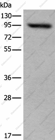 Вестерн-блоттинг, USP6NL, клетки 293T