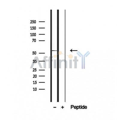 Валидация Affinity DF12449 - 6980