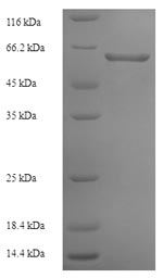 SDS-PAGE