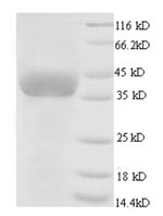 SDS-PAGE