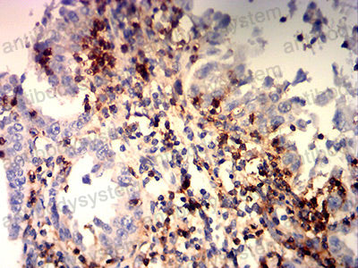 Валидация AntibodySystem RHD69202