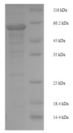 SDS-PAGE