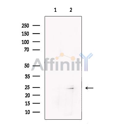 Валидация Affinity DF13694 - 9292