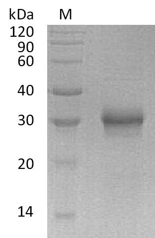 SDS-PAGE