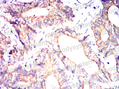 Валидация AntibodySystem RHG06501 (2818)