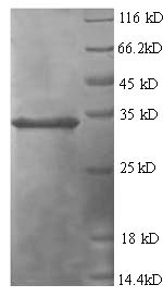 SDS-PAGE
