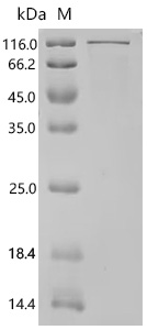 SDS-PAGE