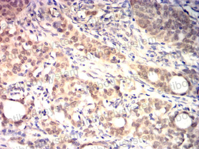 Валидация AntibodySystem RHE05803 (1937)