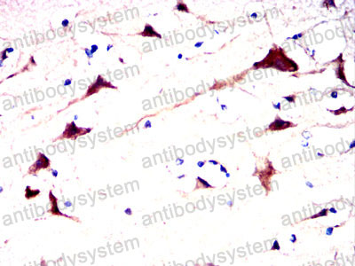 Валидация AntibodySystem RHC01503 (546)