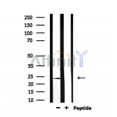 Валидация Affinity DF6579 - 18015
