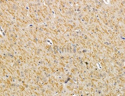 Валидация Affinity DF14858 - 10992