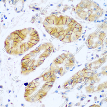 Иммуногистохимия, NCAM1/CD56, ткань желудка человека