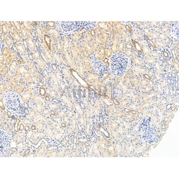 Валидация Affinity DF13454 - 8791