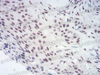 Валидация AntibodySystem RHG43405