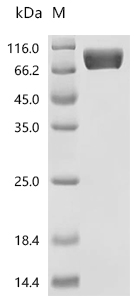 SDS-PAGE