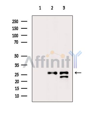 Валидация Affinity AF6674 - 3941