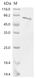 SDS-PAGE