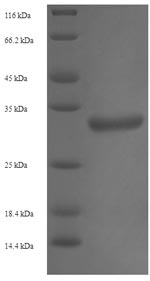 SDS-PAGE