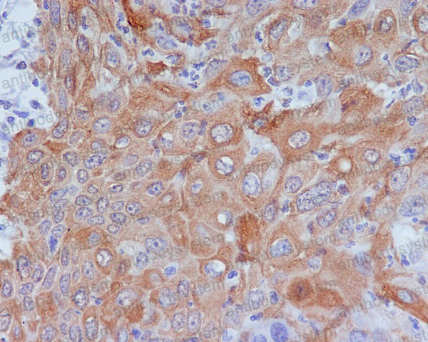 Валидация AntibodySystem RHG16101