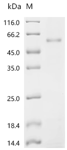 SDS-PAGE