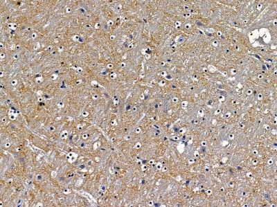 Валидация Affinity DF8615 - 20539