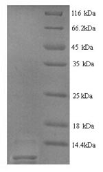 SDS-PAGE