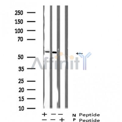 Валидация Affinity AF5432 - 3076