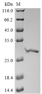 SDS-PAGE