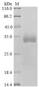 SDS-PAGE