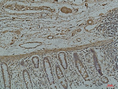 Иммуногистохимия, Galectin 3, ткань толстой кишки человека