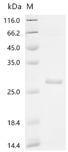 SDS-PAGE