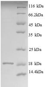 SDS-PAGE